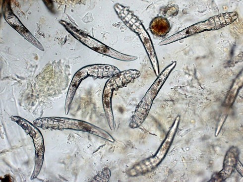 Demodex làm tắc nghẽn các nang và ống dẫn của tuyến bã nhờn làm tăng sản biểu mô, xác và chất thải của Demodex có thể gây ra phản ứng dị ứng. Lúc này mặt bệnh nhân sẽ đỏ, ngứa thường xuyên, người bệnh có thể có cảm giác như kiến bò trên da mặt, đặc biệt vào buổi tối.