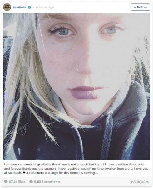 Kesha xúc động bày tỏ sự biết ơn đến những người đã ủng hộ mình thông qua tài khoản Instagram