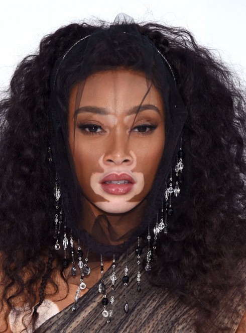 Winnie Harlow