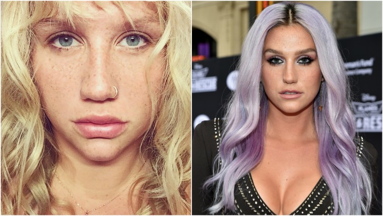 Kesha chẳng khác gì một cô gái dễ thương với những đốm tàng nhang trên mặt