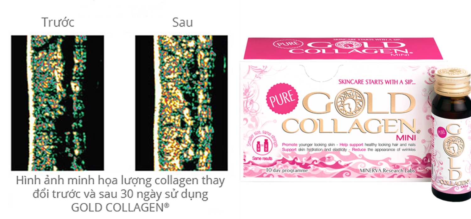 Gold Collagen: Bí quyết vàng để “trẻ mãi không già”