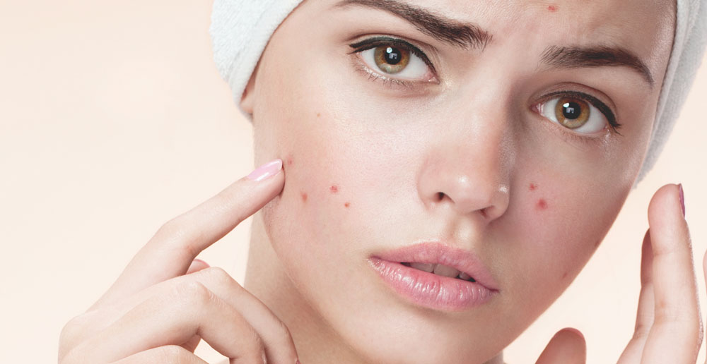 Cách chăm sóc da mặt cho từng loại da - không dễ như bạn tưởng! 