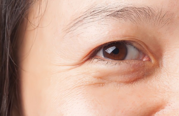Kem dưỡng mắt có cần thiết không?