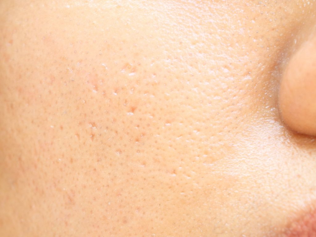 4 bí quyết chăm sóc da mặt đang gây tranh cãi trong giới làm đẹp