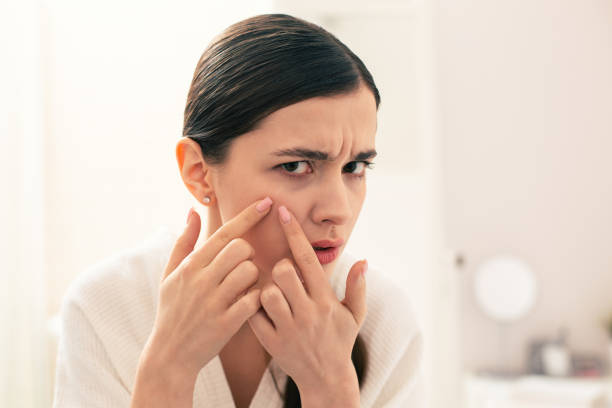 Chăm sóc da những người có làn da khô, da bị mụn, mới nặn mụn, vừa mới áp dụng biện pháp laser không nên dùng Vitamin C