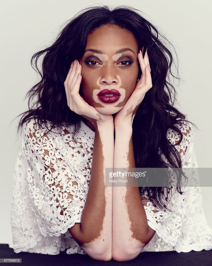 điểm tin thời trang người mẫu winnie harlow 1