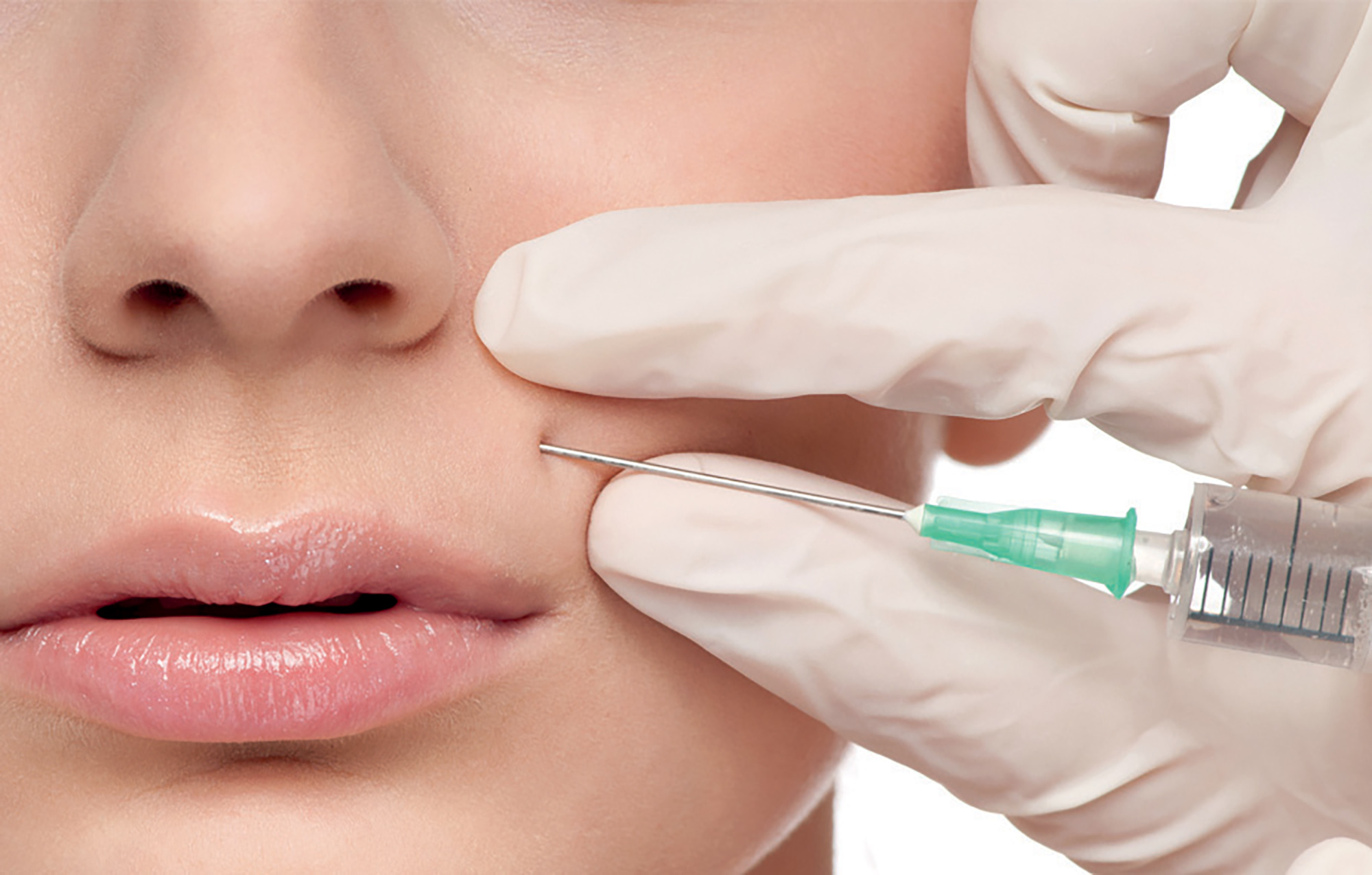 làm đẹp không xâm lấn phương pháp tiêm botox cho gương mặt