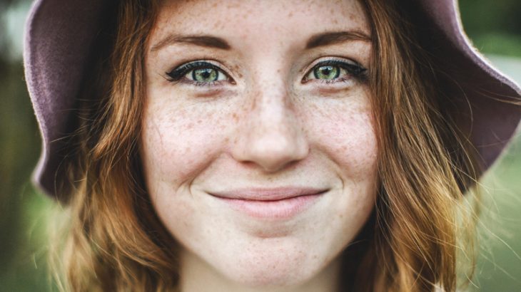 7 cách đánh bay tàn nhang cho làn da rạng rỡ