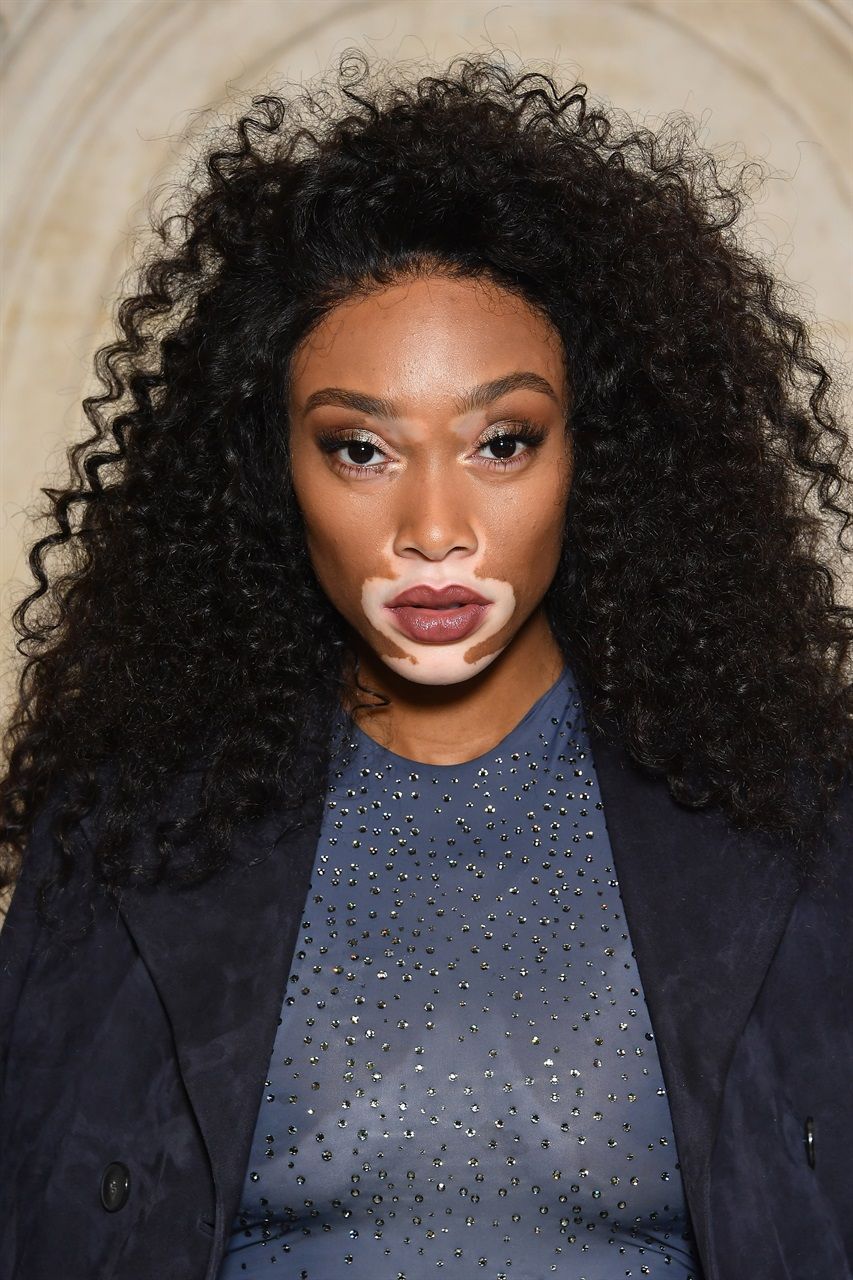 Winnie Harlow và tóc layer