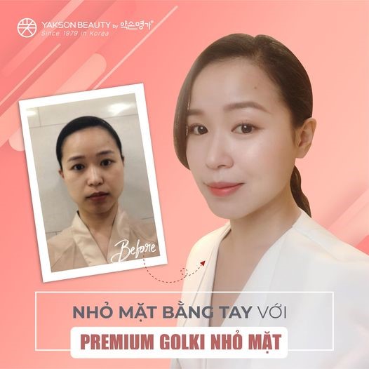 Khắc phục nhược điểm trên gương mặt bằng phương pháp Golki