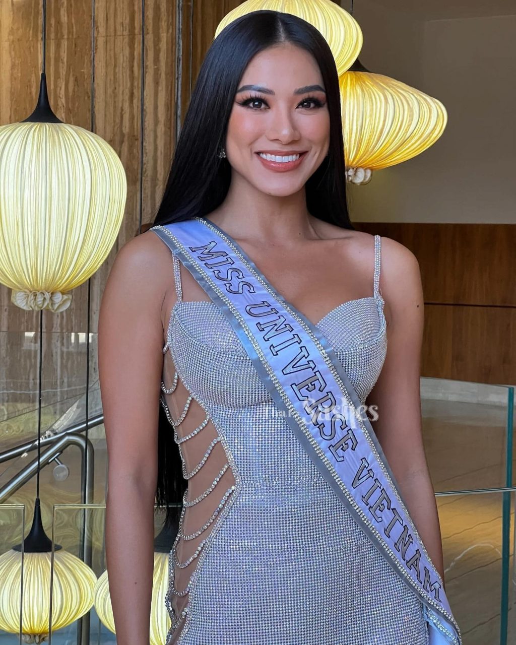 Á hậu Kim Duyên thực hiện dịch vụ Niềng răng 6 MONTHS SMILE của nha khoa Blossom trước khi trước khi tham dự Miss Universe 2021.
