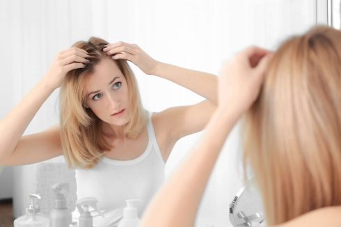 Nghệ có thể được sử dụng trong điều trị các bệnh da đầu khác nhau như viêm da và eczema có thể dẫn đến ngứa, bong tróc da, viêm và tóc mỏng. Ảnh: Dermatology of North Asheville. 