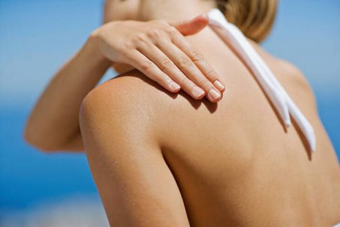 Bảo vệ làn da của bạn khỏi tác hại của ánh nắng mặt trời là rất quan trọng, đặc biệt nếu bạn để lộ lưng trần. Ảnh: Getty Images.