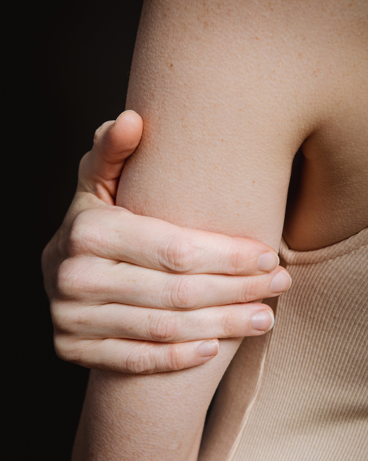 Keratosis Pilaris gây ra các mảng khô ráp và các nốt sần nhỏ trên cánh tay, đùi, má hoặc mông.