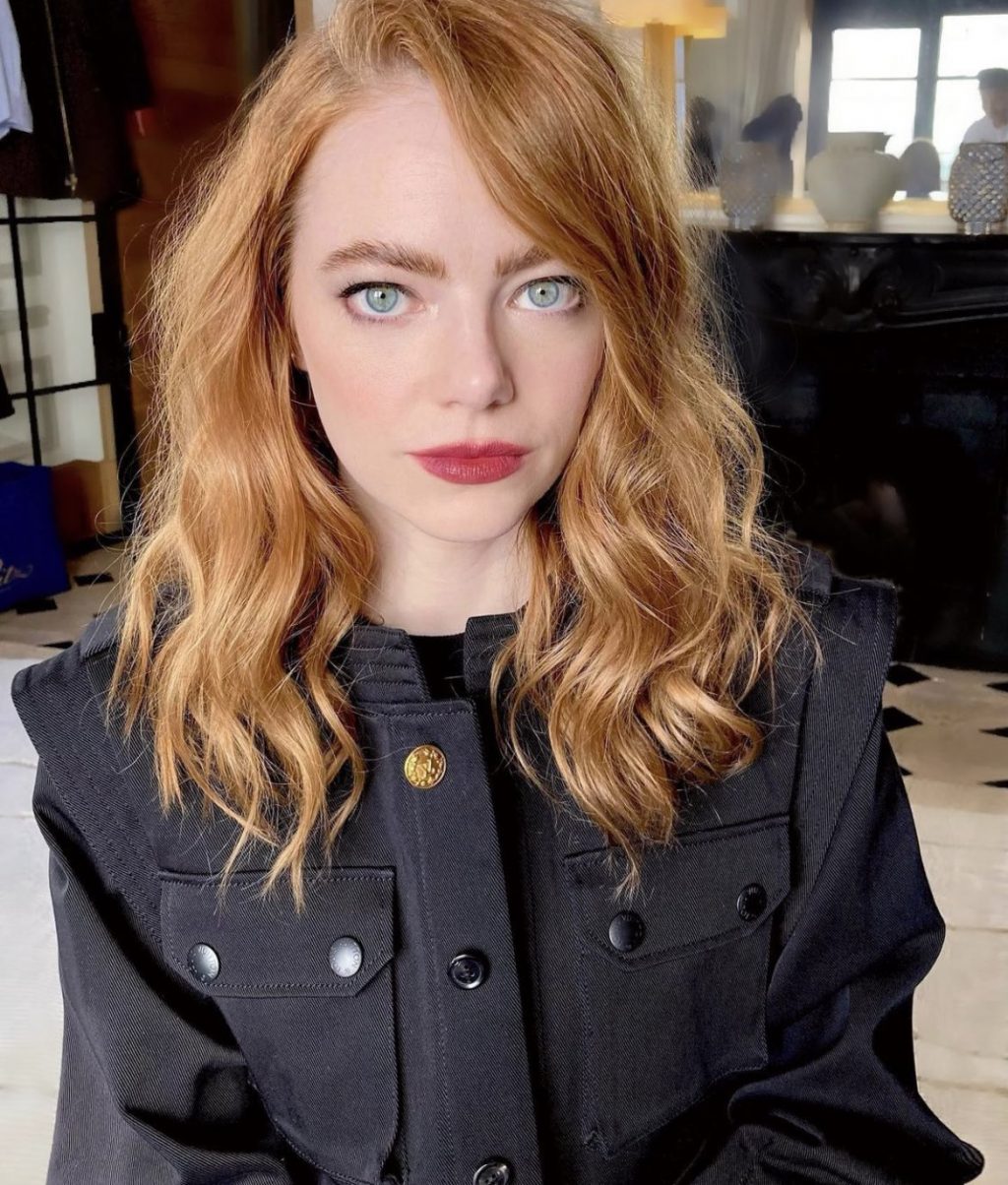 tự tin với tàn nhang như thần tượng emma stone của bạn