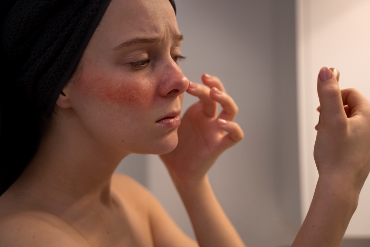 Làn da sẽ trở nên nhạy cảm và dễ tổn thương nếu bạn không rửa mặt