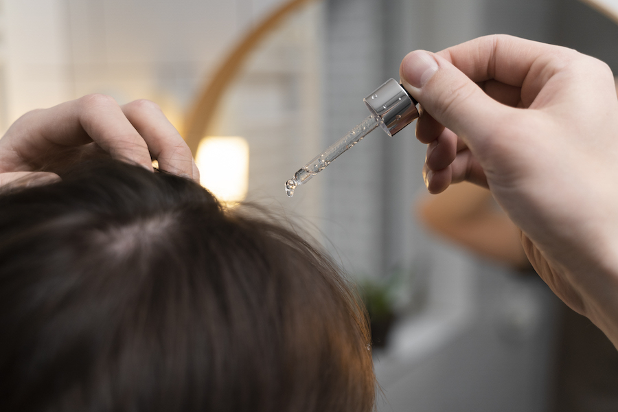 Cách dùng minoxidil cho người rụng tóc hói đầu