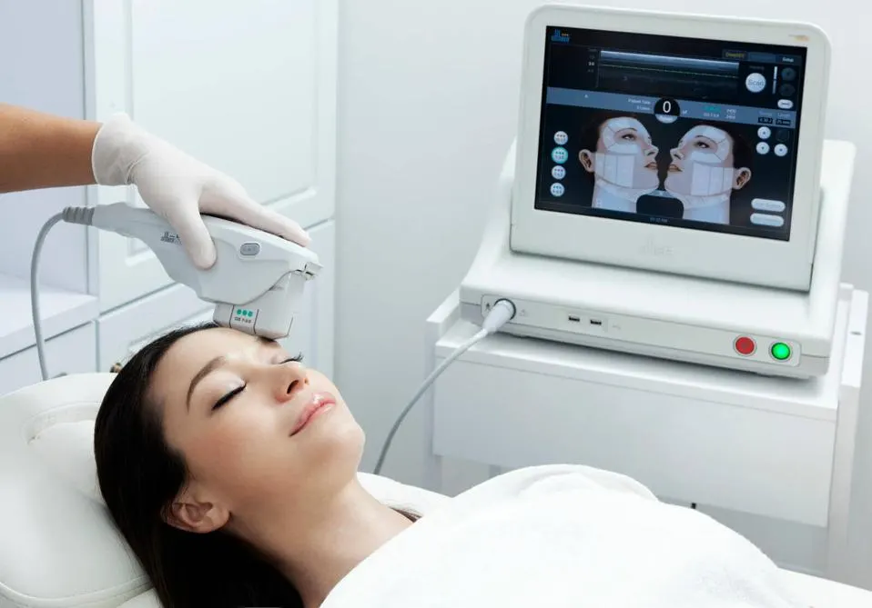 Nâng cơ da mặt cô gái bằng Ultherapy